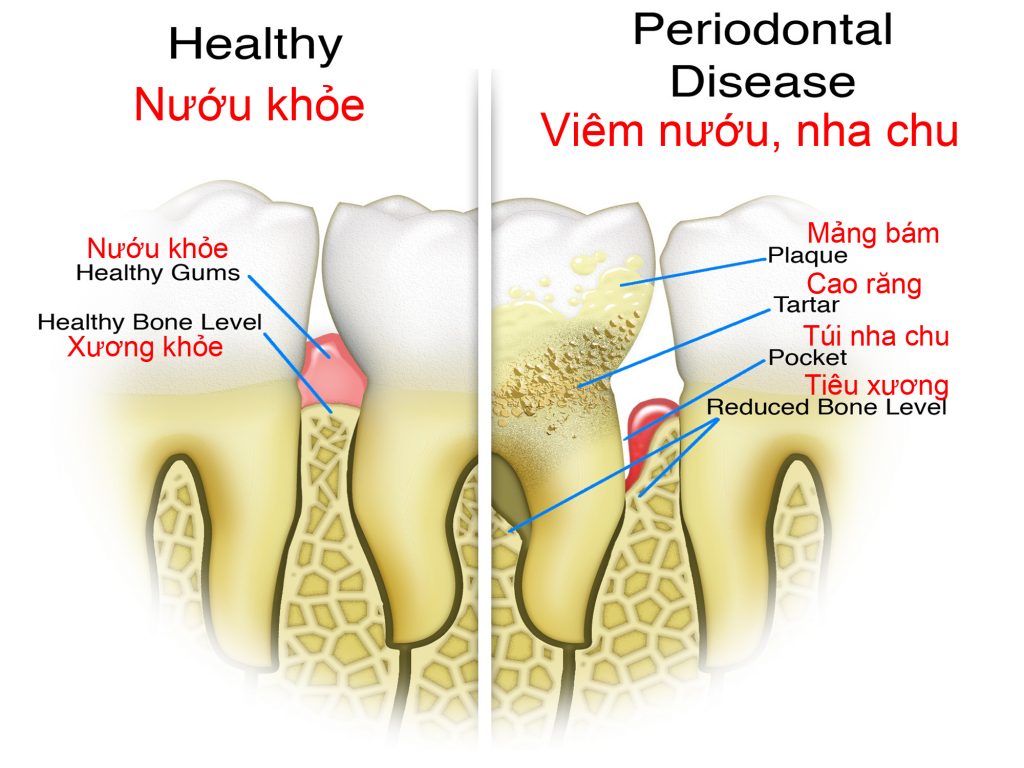 Bệnh Nha Chu Ở Quận 1 Và Bảng Giá Tham Khảo