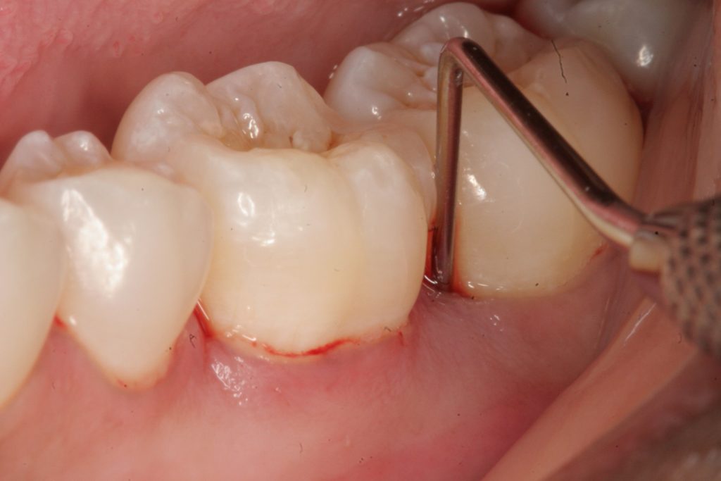 Nhận Biết Bệnh Qua Biểu Hiện Của Răng – Nha Khoa Xinh Xinh