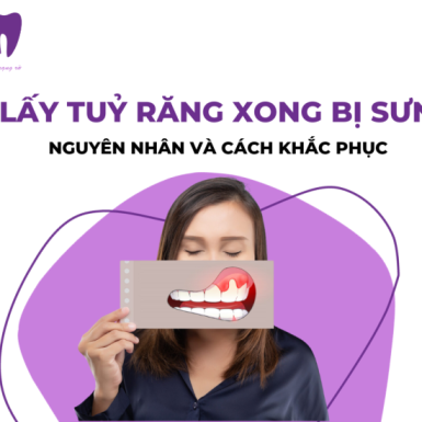 Lấy Tuỷ Răng Xong Bị Sưng: Nguyên Nhân và Khắc Phục