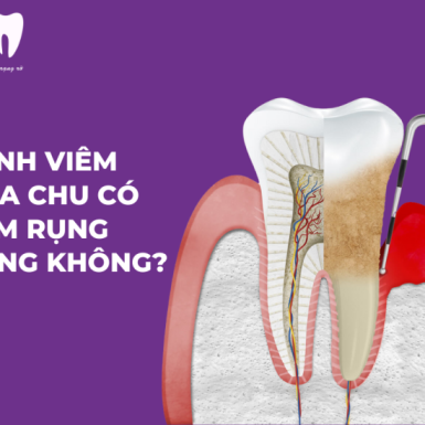 Bệnh Viêm Nha Chu Có Làm Rụng Răng Không?