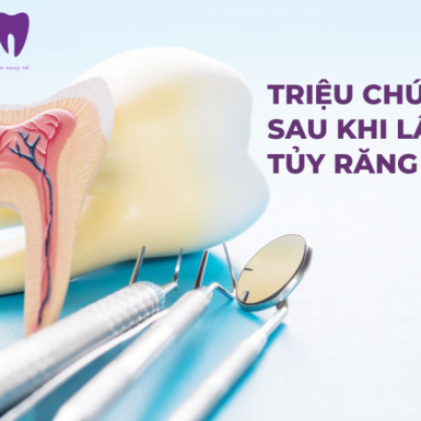 Các Triệu Chứng Sau Khi Lấy Tủy Răng Thường Gặp