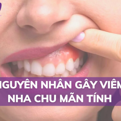Nguyên Nhân Gây Viêm Nha Chu Mãn Tính – Cách Chữa Trị