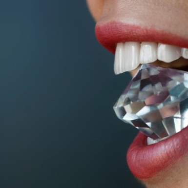 Răng Sứ Zirconia Có Thật Sự Tốt?