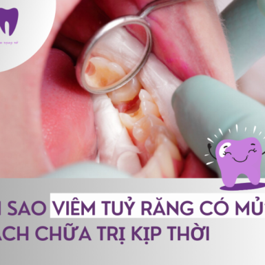 Tại sao Viêm Tuỷ Răng Có Mủ? Cách chữa trị kịp thời