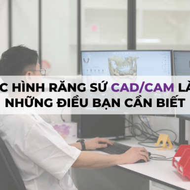 Phục Hình Răng Sứ CAD/CAM là gì? Những Điều Bạn Cần Biết