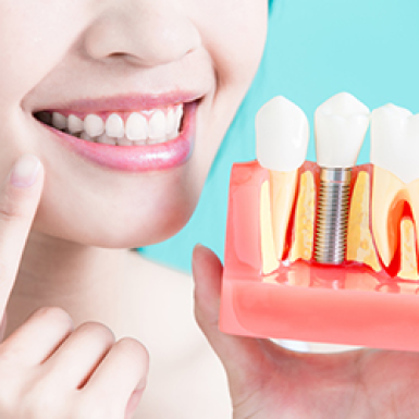 Phẫu Thuật Ghép Xương Nhân Tạo Để Cấy Ghép Implant