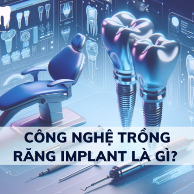Công Nghệ Trồng Răng Implant là gì? Giá bao nhiêu?