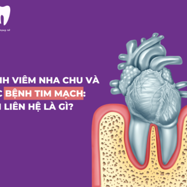 Bệnh viêm nha chu và các bệnh tim mạch: Mối liên hệ là gì?