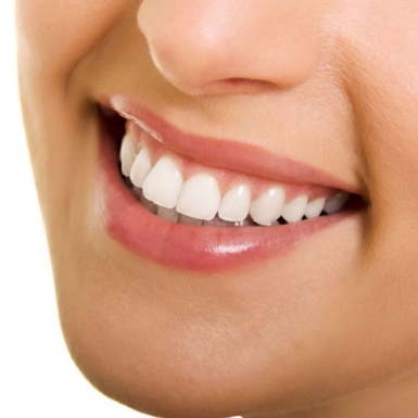 Làm Trắng Răng Ở Quận 1 – Nha Khoa Xinh Xinh