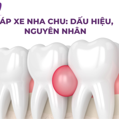 Áp Xe Nha Chu: Dấu hiệu, Nguyên Nhân và Cách Phòng Ngừa