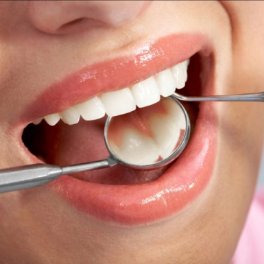 Trồng Răng Ở Quận 1 Uy Tín Chất Lượng