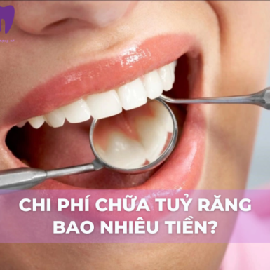 Chi Phí Chữa Tuỷ Răng Bao Nhiêu Tiền?
