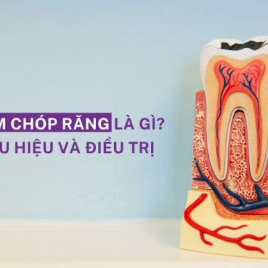 Viêm Chóp Răng Là Gì? Dấu Hiệu và Điều Trị