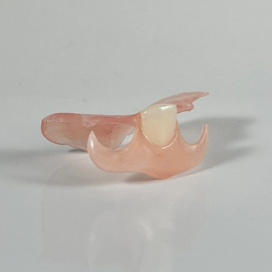 Phục Hình Răng Giả Tháo Lắp – Ưu và Nhược Điểm