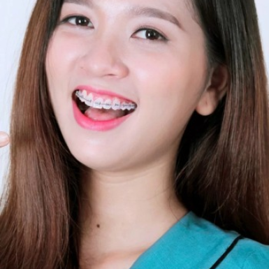 Bảng giá dịch vụ tại phòng khám nha khoa quận 1 mới nhất