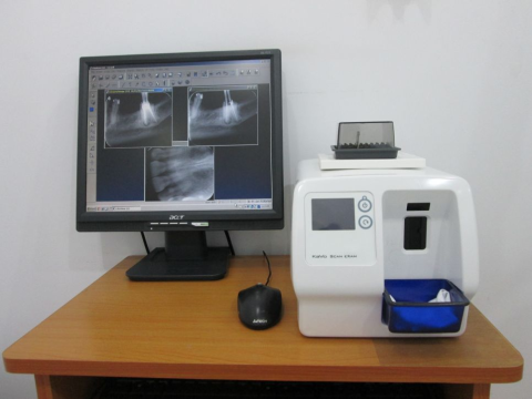 Máy Scan Phim Kavo