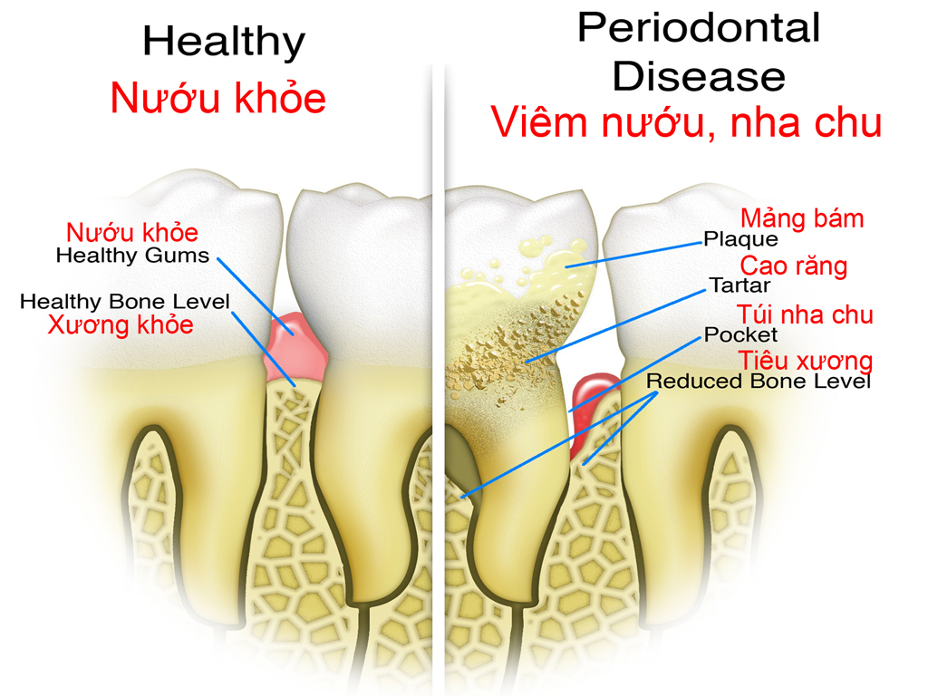 Ba Sai Lầm Lớn Trong Chăm Sóc Răng Miệng