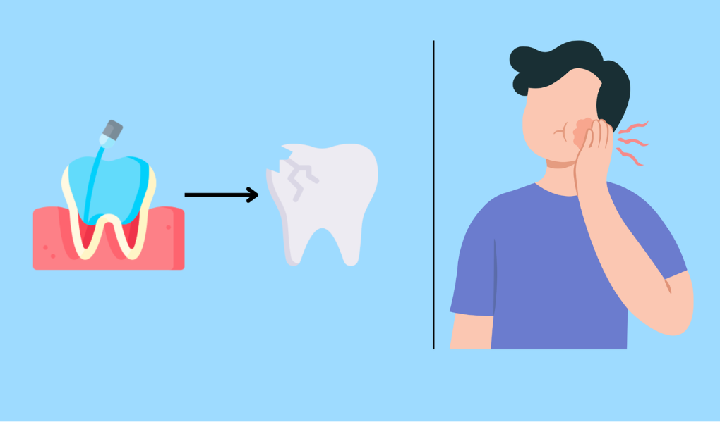 Ưu điểm của phương pháp điều trị viêm tuỷ