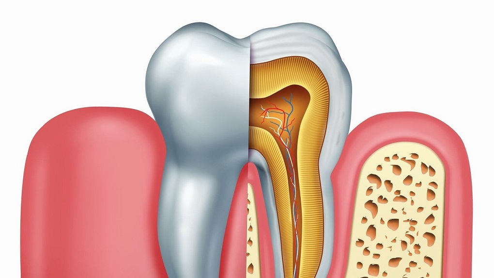 lấy tuỷ răng xong vẫn bị đau 