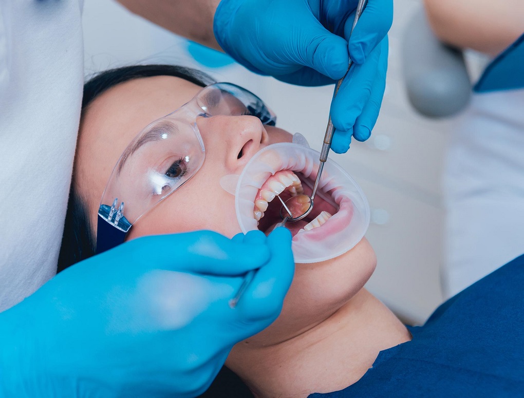Cách Bảo Vệ Răng Sau Khi Chữa Tủy Răng