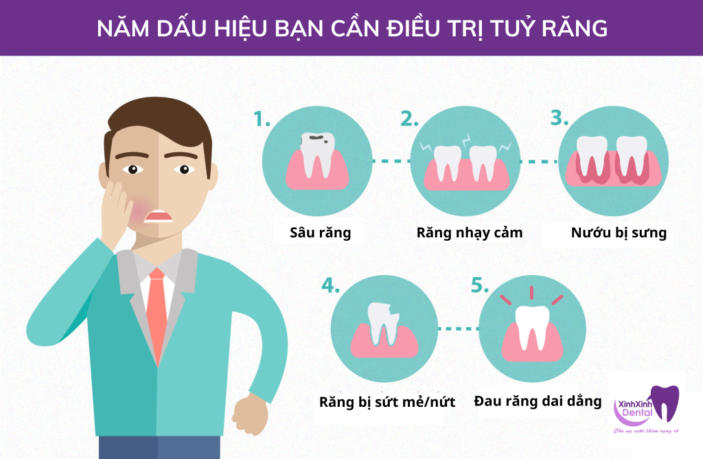 Răng Đang Đau Có Nên Lấy Tuỷ Không