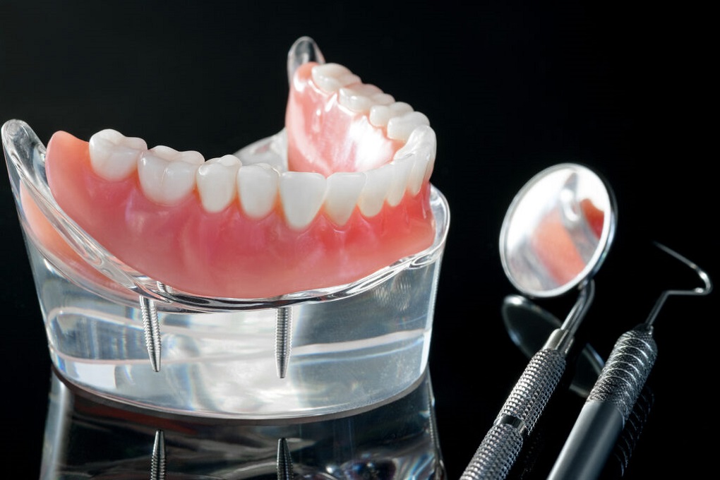 Phục Hình Răng Giả Tháo Lắp