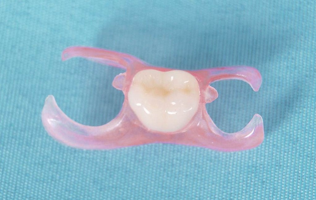 Răng Giả Tháo Lắp 1 Chiếc