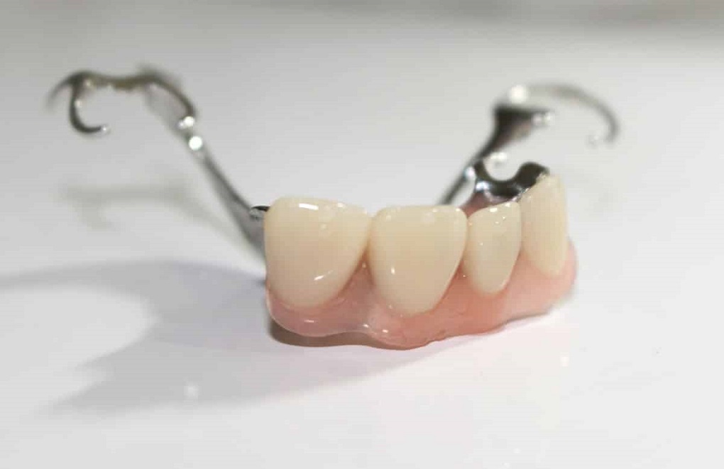 Răng Giả Tháo Lắp 1 Chiếc