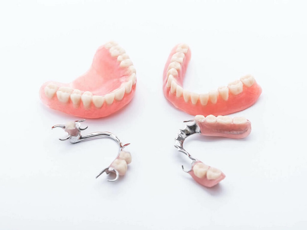 So Sánh Răng Giả Cố Định và Răng Giả Tháo Lắp