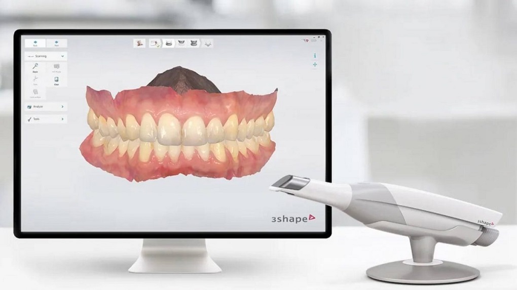 Phục Hình Răng Sứ CAD-CAM là gì