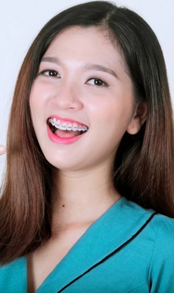 dịch vụ thẩm mỹ phòng khám nha khoa quận 1