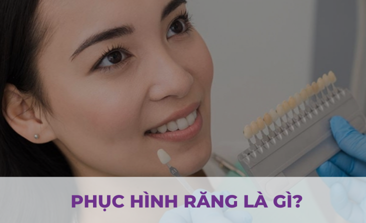 Phục Hình Răng Là Gì